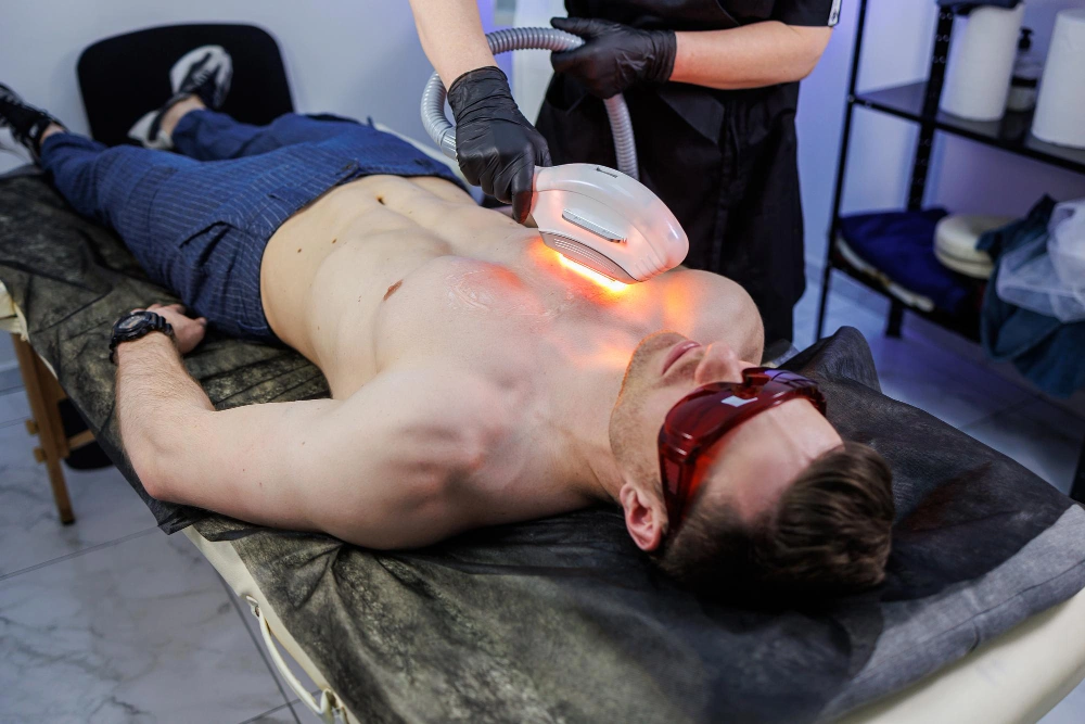 Laser Hair Removal For Men