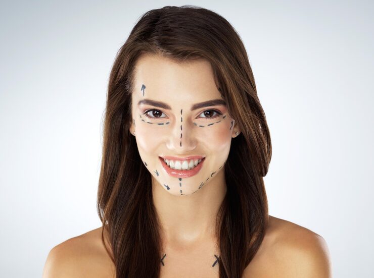 Vampire Facelift