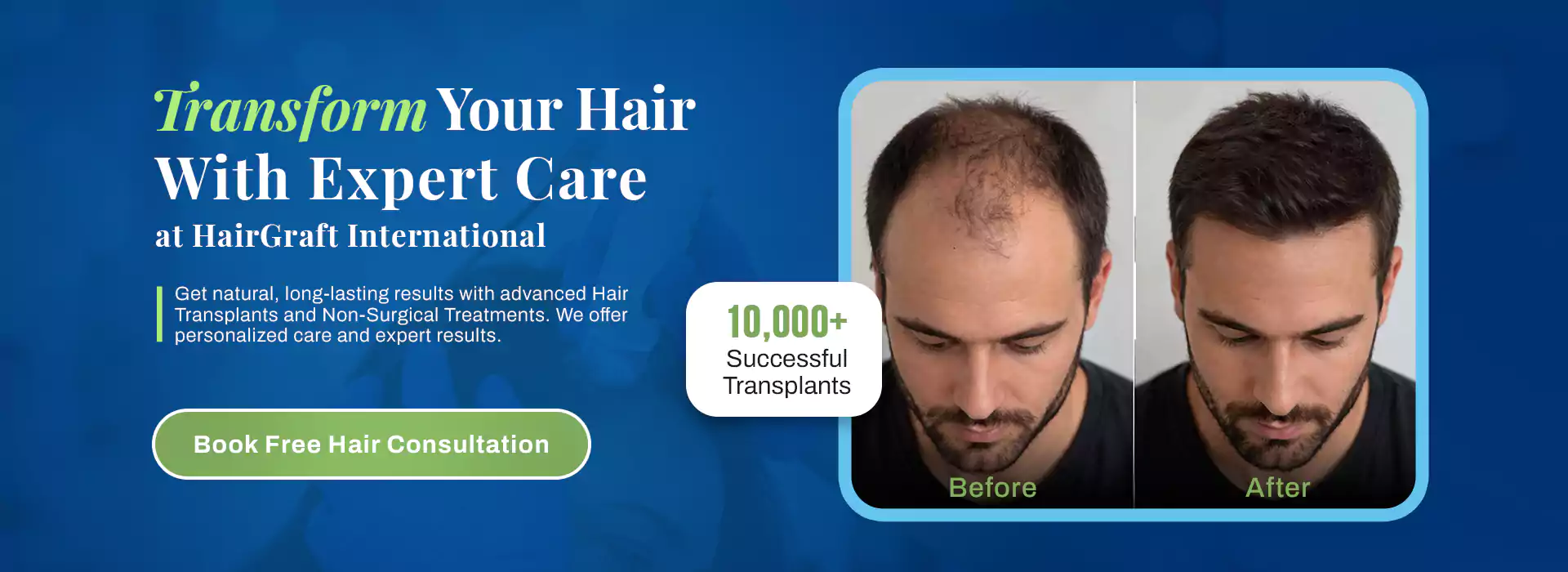 HAIR GRAFT AD BANNER (2)